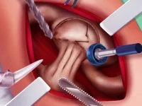 Princess Hips Surgery image